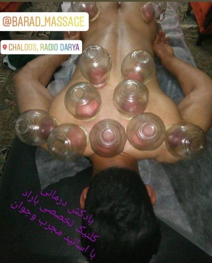  بادکش درمانی