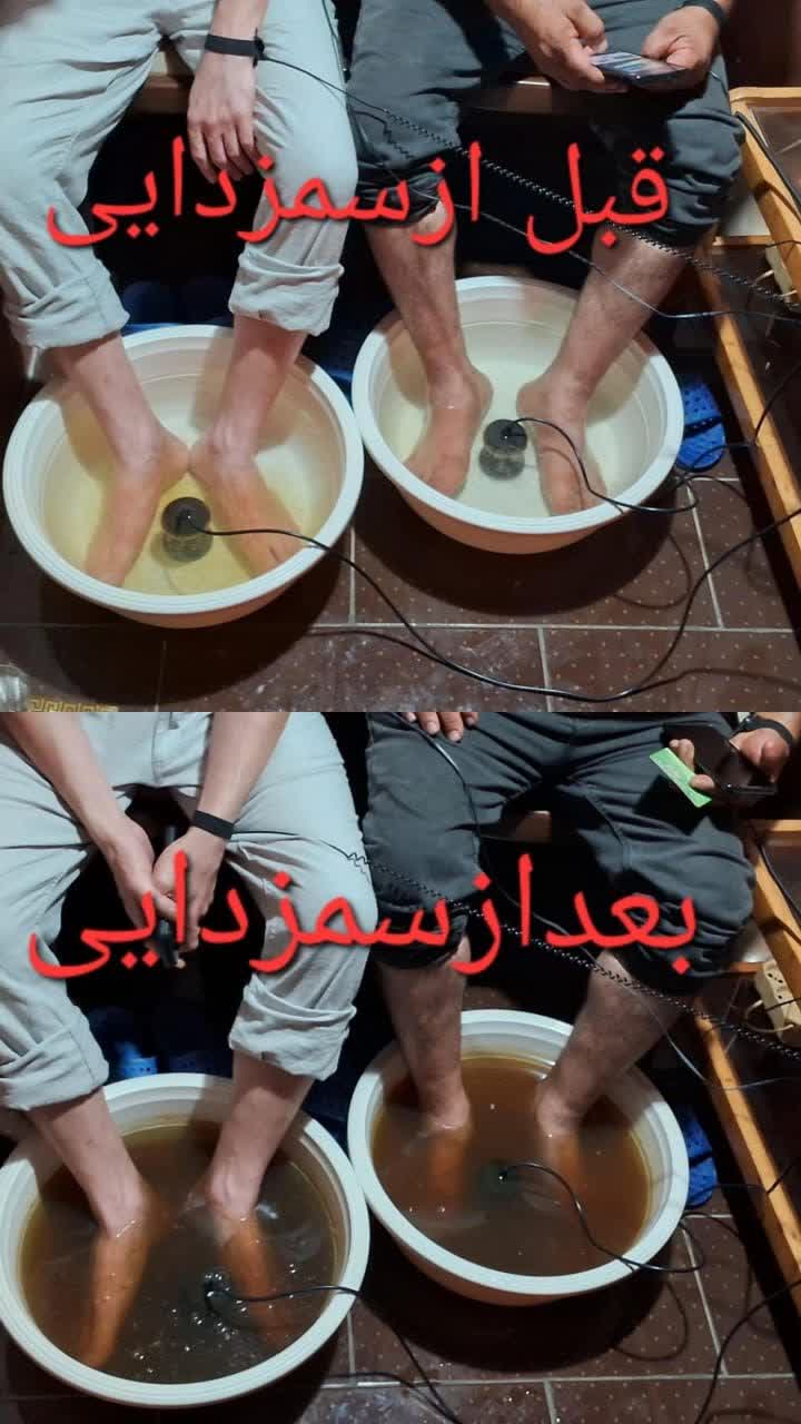 سم زدایی در باراد