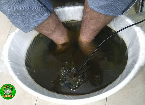  سم زدایی در باراد