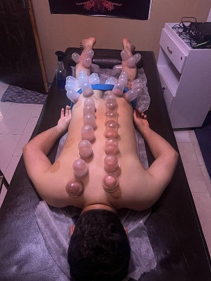 بادکش درمانی